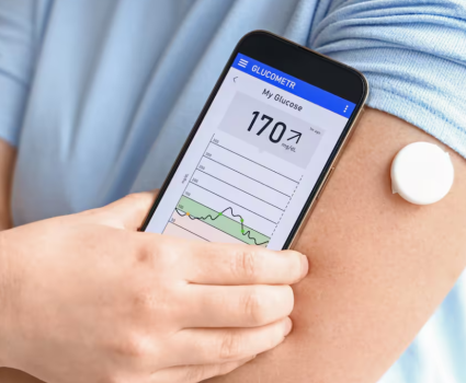 ¿Cómo funciona el Monitoreo Continuo de Glucosa?