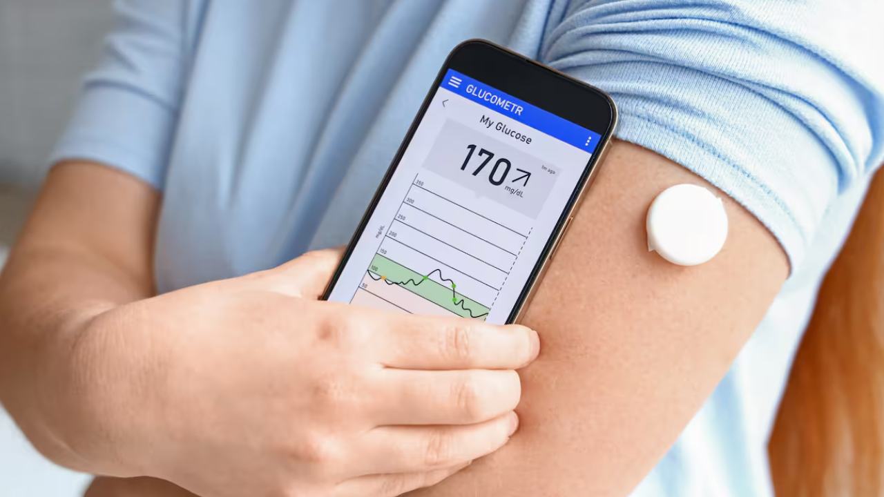 ¿Cómo funciona el Monitoreo Continuo de Glucosa?